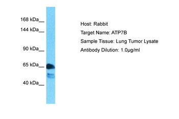 ATP7B Rabbit Polyclonal Antibody
