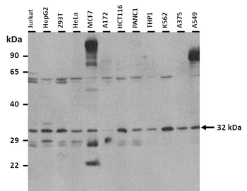 SDCBP Rabbit Polyclonal Antibody