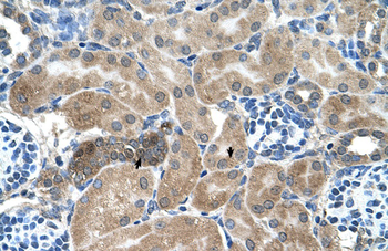 SDCBP Rabbit Polyclonal Antibody