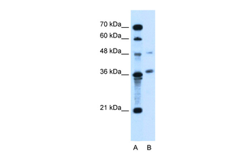 ARMCX6 Rabbit Polyclonal Antibody