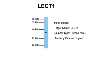 CNMD Rabbit Polyclonal Antibody