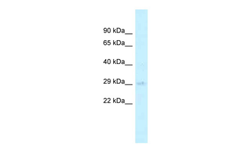 AGPAT2 Rabbit Polyclonal Antibody