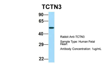 TCTN3 Rabbit Polyclonal Antibody