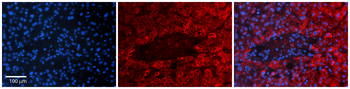 TCTN3 Rabbit Polyclonal Antibody
