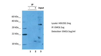 TMEM93 Rabbit Polyclonal Antibody