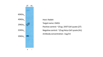 TMEM93 Rabbit Polyclonal Antibody