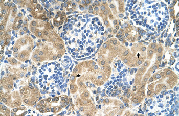 TM9SF1 Rabbit Polyclonal Antibody