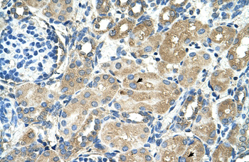 TM9SF1 Rabbit Polyclonal Antibody
