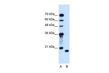 PTRH2 Rabbit Polyclonal Antibody