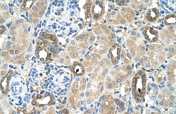 MGAT2 Rabbit Polyclonal Antibody