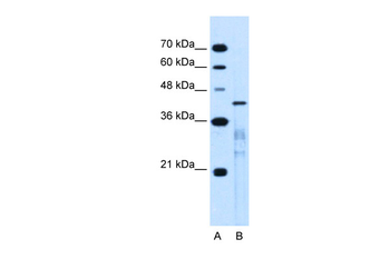 MARVELD3 Rabbit Polyclonal Antibody