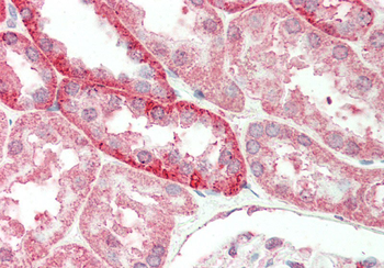 LETMD1 Rabbit Polyclonal Antibody