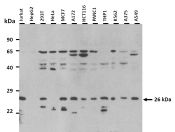 TSPAN4 Rabbit Polyclonal Antibody
