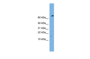 IFITM5 Rabbit Polyclonal Antibody