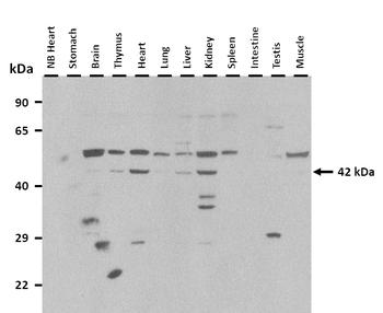 Ctns Rabbit Polyclonal Antibody