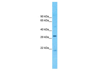 CCDC90A Rabbit Polyclonal Antibody