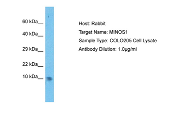 C1orf151 Rabbit Polyclonal Antibody