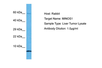 C1orf151 Rabbit Polyclonal Antibody