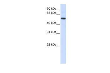ENTPD8 Rabbit Polyclonal Antibody