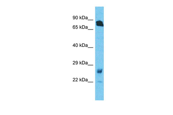 RHOT1 Rabbit Polyclonal Antibody