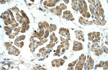 RHOT1 Rabbit Polyclonal Antibody