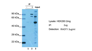 RHOT1 Rabbit Polyclonal Antibody