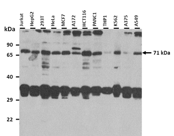 RHOT1 Rabbit Polyclonal Antibody