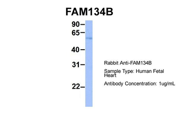 RETREG1 Rabbit Polyclonal Antibody