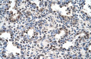 RETREG1 Rabbit Polyclonal Antibody