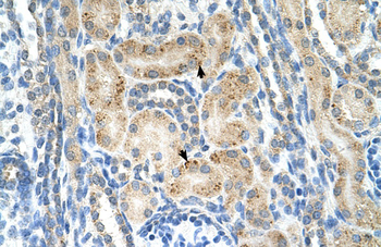 NRCAM Rabbit Polyclonal Antibody