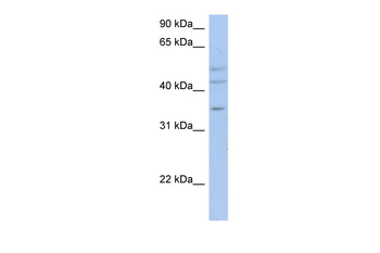 PXYLP1 Rabbit Polyclonal Antibody