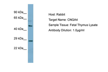 CNGA4 Rabbit Polyclonal Antibody