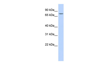 GALC Rabbit Polyclonal Antibody