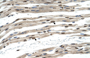 SIL1 Rabbit Polyclonal Antibody