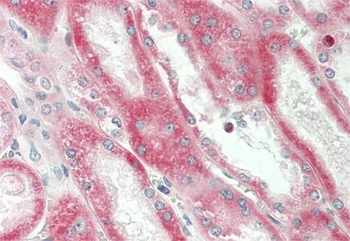 SIL1 Rabbit Polyclonal Antibody