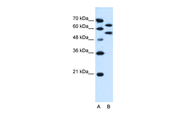 SIL1 Rabbit Polyclonal Antibody