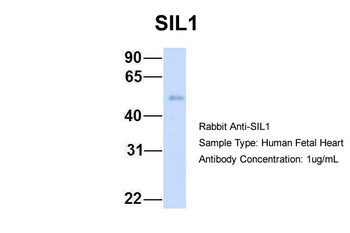 SIL1 Rabbit Polyclonal Antibody