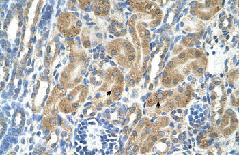 PARL Rabbit Polyclonal Antibody