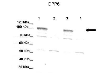 DPP6 Rabbit Polyclonal Antibody