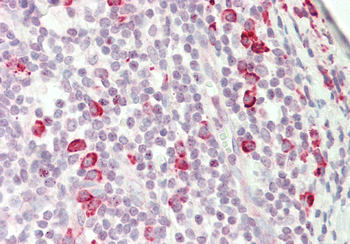 KIAA0317 Rabbit Polyclonal Antibody