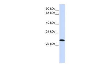 ZDHHC19 Rabbit Polyclonal Antibody