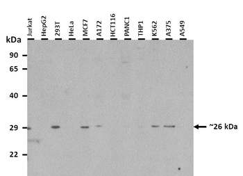 MOSPD3 Rabbit Polyclonal Antibody