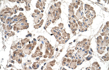 MOSPD3 Rabbit Polyclonal Antibody