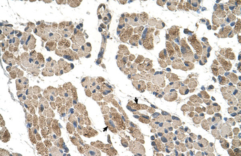 CLCC1 Rabbit Polyclonal Antibody