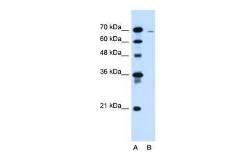CLCC1 Rabbit Polyclonal Antibody