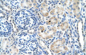 SPPL2B Rabbit Polyclonal Antibody