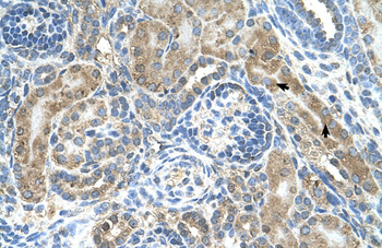 CRELD1 Rabbit Polyclonal Antibody