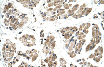FKTN Rabbit Polyclonal Antibody
