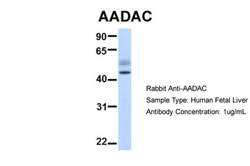 AADAC Rabbit Polyclonal Antibody