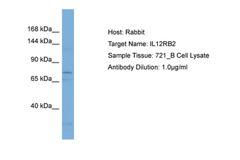 IL12RB2 Rabbit Polyclonal Antibody